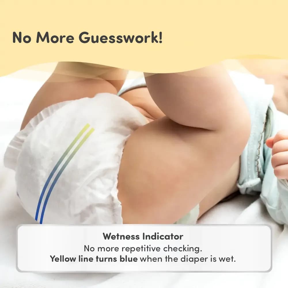 Mylo Baby New Born Tape Diapers | Size upto 5 kgs | 52 count | Naval Protection | Wetness Indicator | Rash Free | 12 Hours Protection