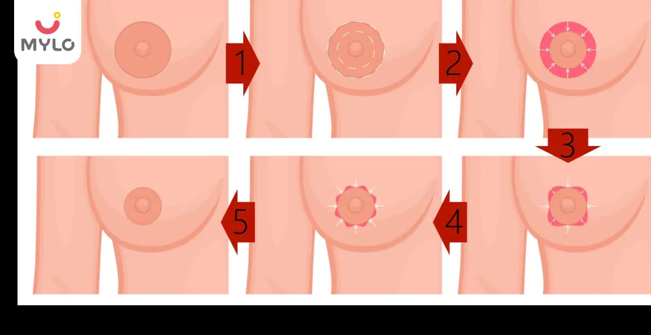 Big Areolas: A Comprehensive Guide to Causes, Risks and Treatments