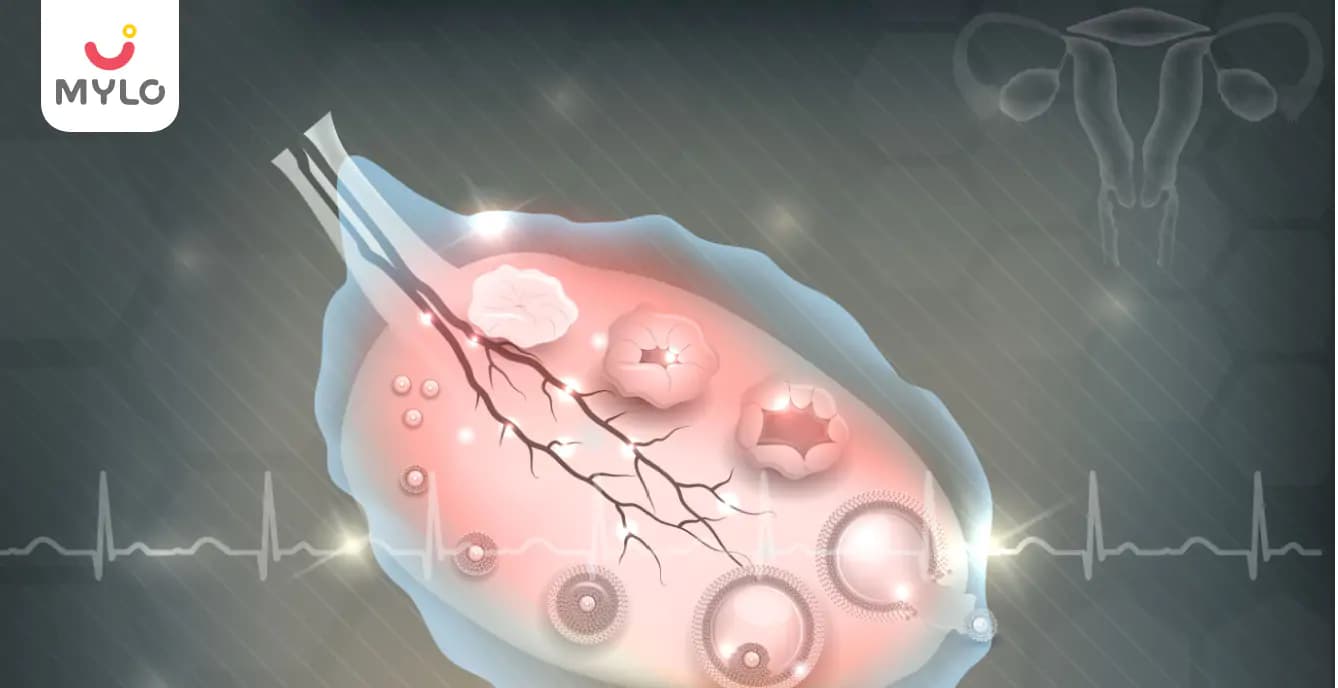 Ovulation disorders and their medications
