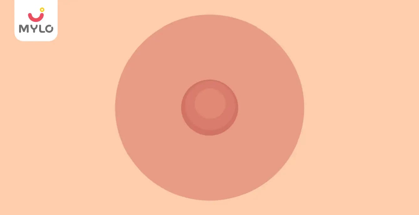 স্তনের উপর সাদা দাগ: লক্ষণ, কারণ এবং চিকিৎসা | White Spots on Nipple: Causes, Symptoms, and Treatments in Bengali