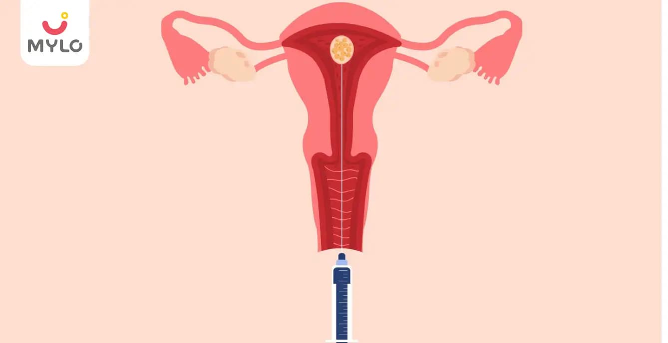 Embryo Transfer: The Ultimate Guide to Procedure, Success Rates and FAQs 