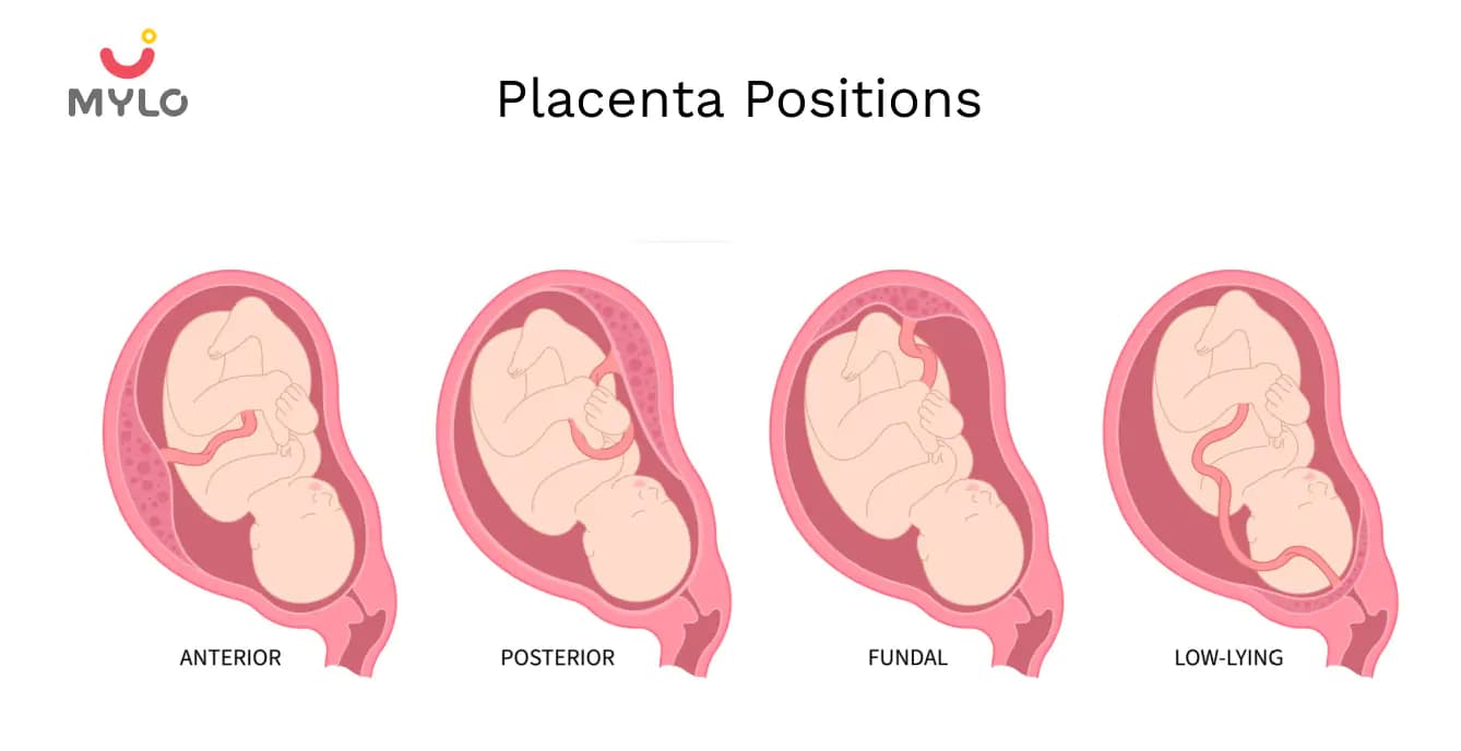 Placenta Position: How It Affects Your Pregnancy and Delivery