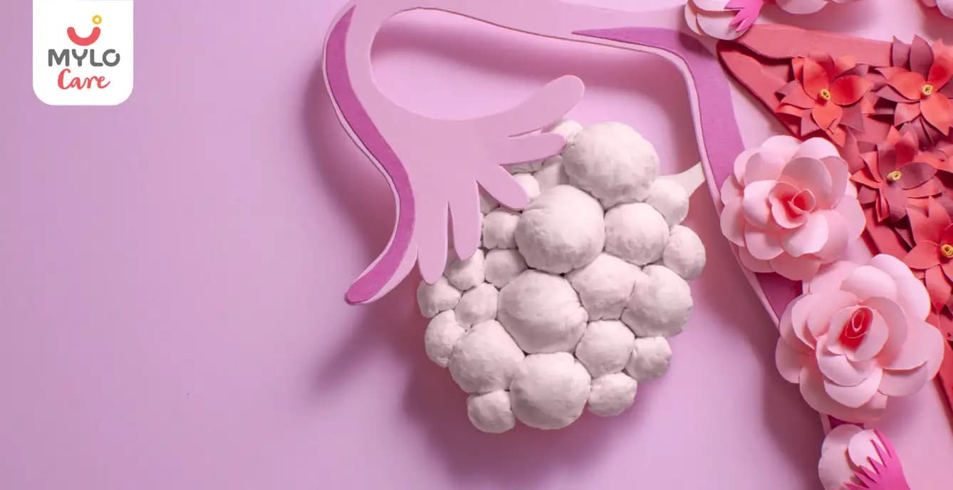 The Ultimate Guide on How to Shrink Ovarian Cysts Naturally