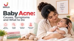 Baby Acne: Causes, Symptoms and What to Do
