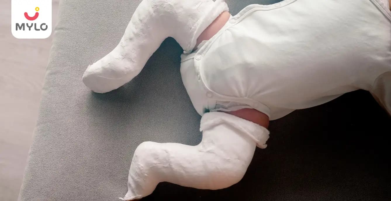 Clubfoot (Talipes Equinovarus): Meaning, Symptoms & More