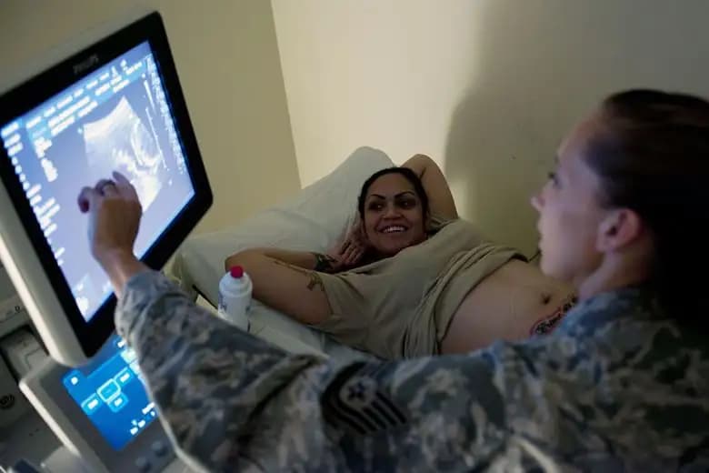 Screening for Down Syndrome in Babies