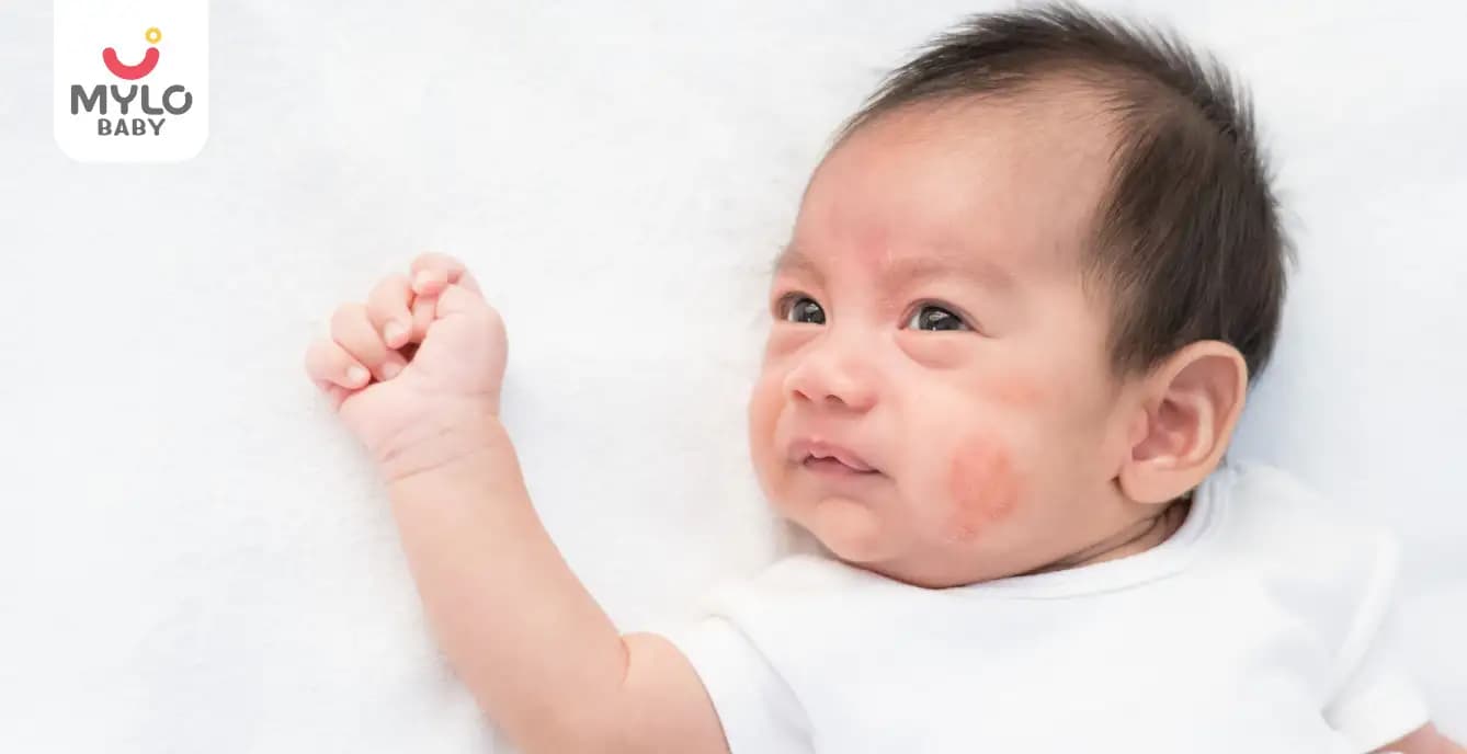 Allergy symptoms and their treatment in children in Hindi | क्या हैं बच्चों में एलर्जी के लक्षण और उनका इलाज   