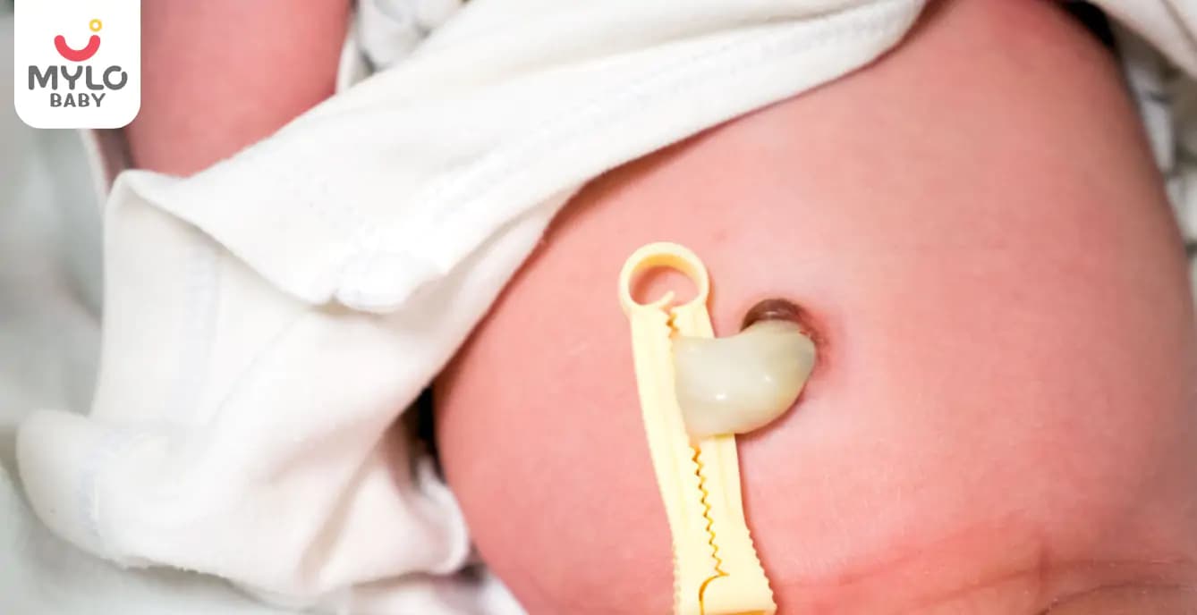 குழந்தைகளுக்கு ஏற்படும் தொப்புள் குடலிறக்கம் - ஒரு பார்வை (Umbilical Hernia in children - An overview In Tamil)