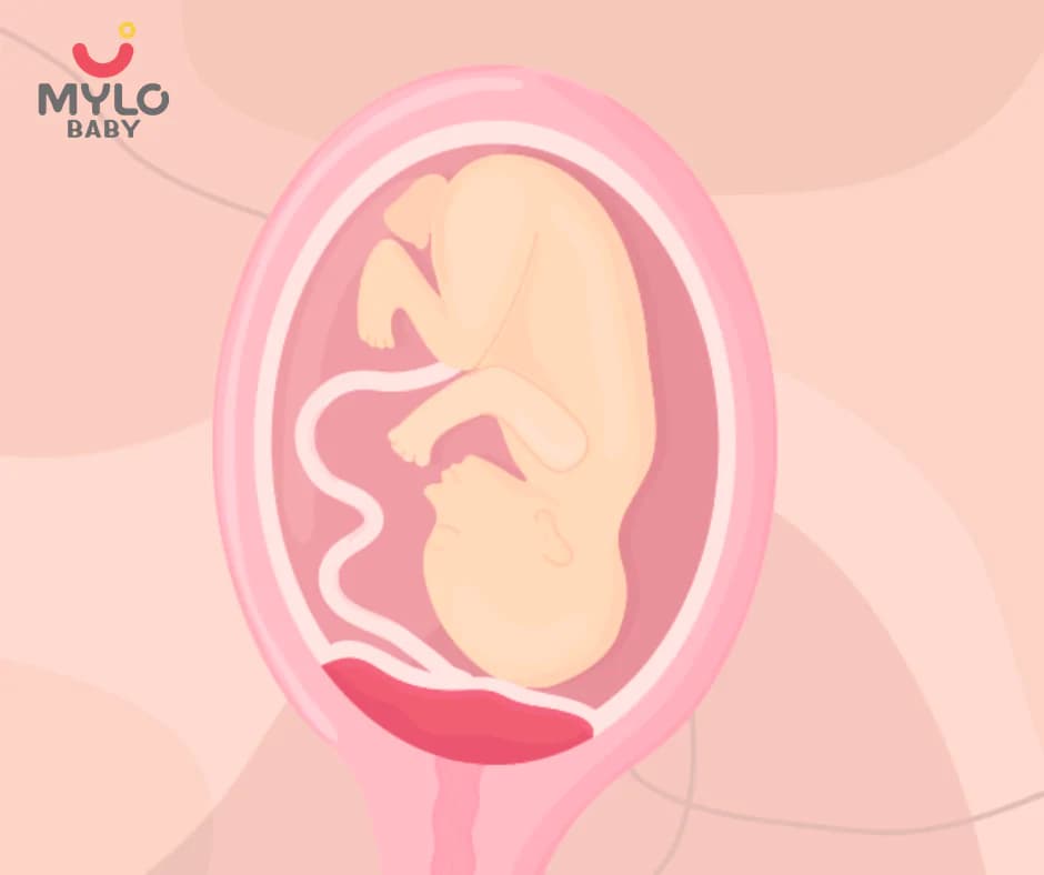 Low-Lying Placenta क्या है? लक्षण, कारण और इलाज की पूरी गाइड (2026)