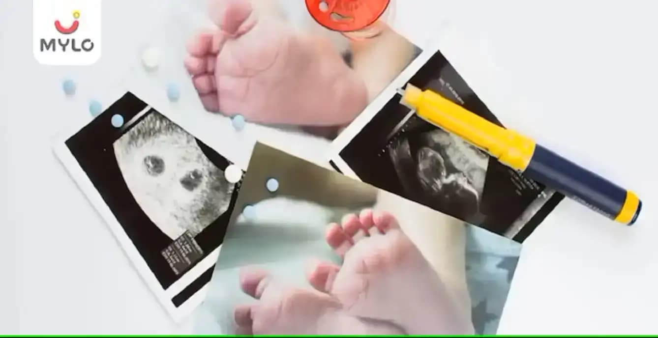 ஐயூஐ(IUI) முறையைப் பயன்படுத்தி கருத்திரிக்க எத்தனை நாட்கள் ஆகும்? 
