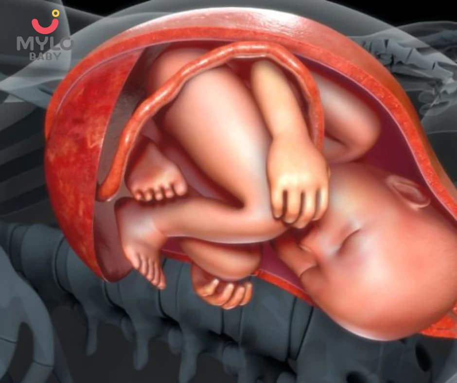 क्या गर्दन पर लिपटी हुई नाल बच्चे के स्वास्थ्य के लिए घातक है | Is a cord wrapped around the neck dangerous for the baby's health?