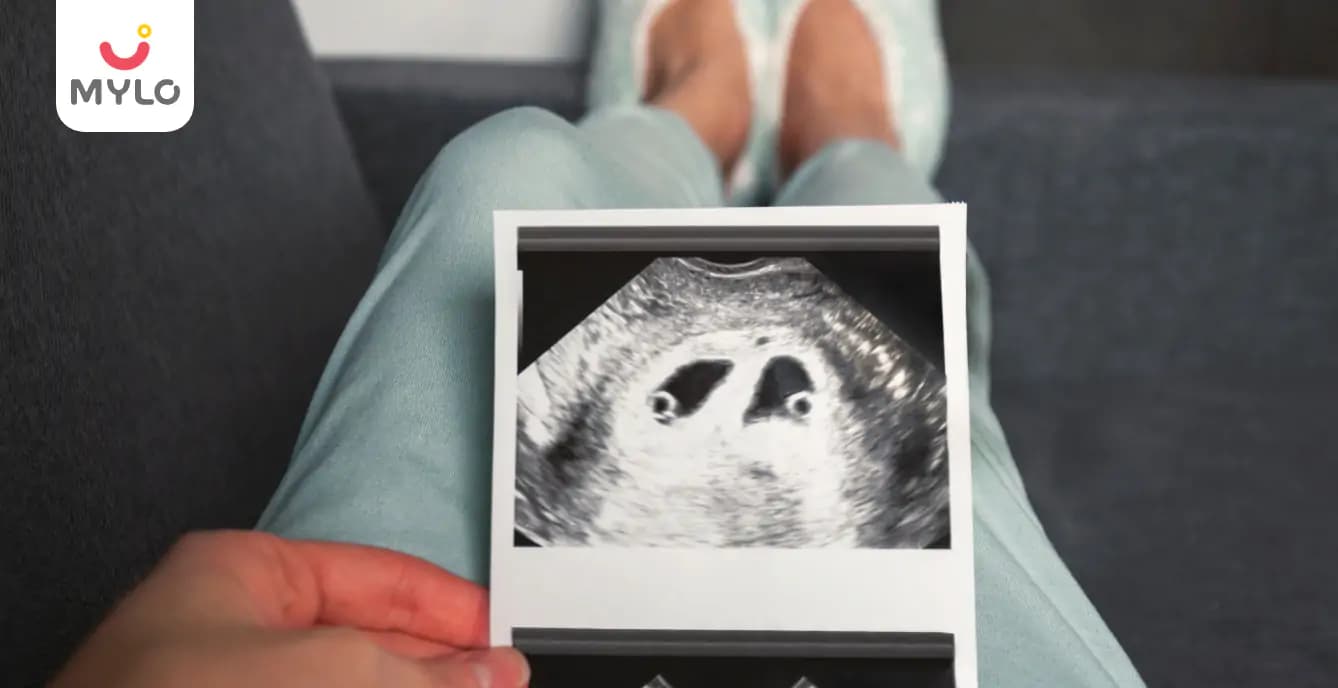 The Ultimate Guide to Twin Pregnancy Symptoms at 4 Weeks