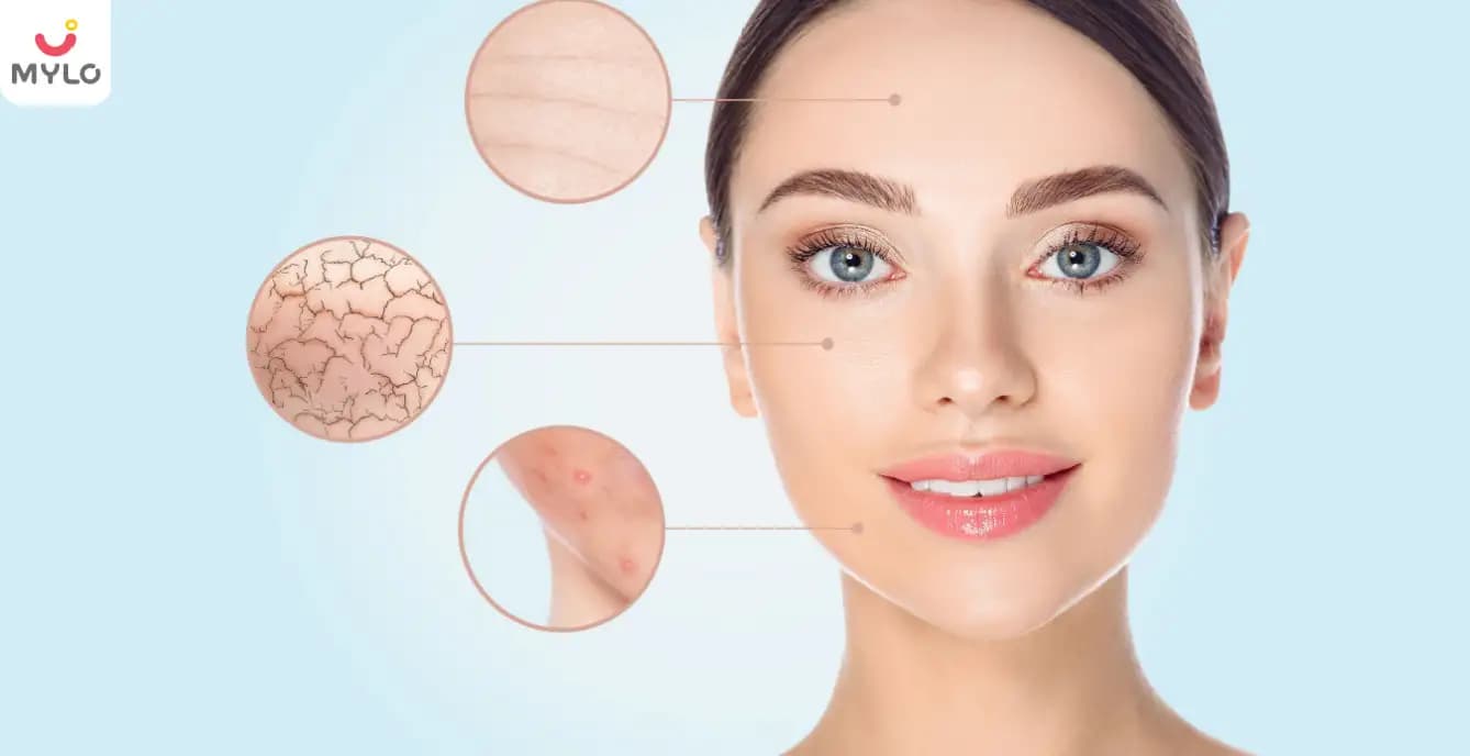 Skin Problems in Hindi | त्वचा से संबंधित इन समस्याओं को न करें नज़रअंदाज!