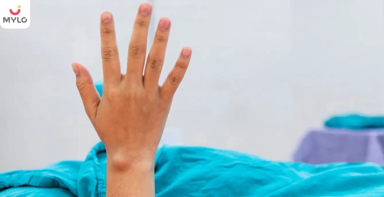 Ganglion Cyst in Hindi | गैंगलियन सिस्ट क्या है? जानें इसके शुरुआती लक्षण