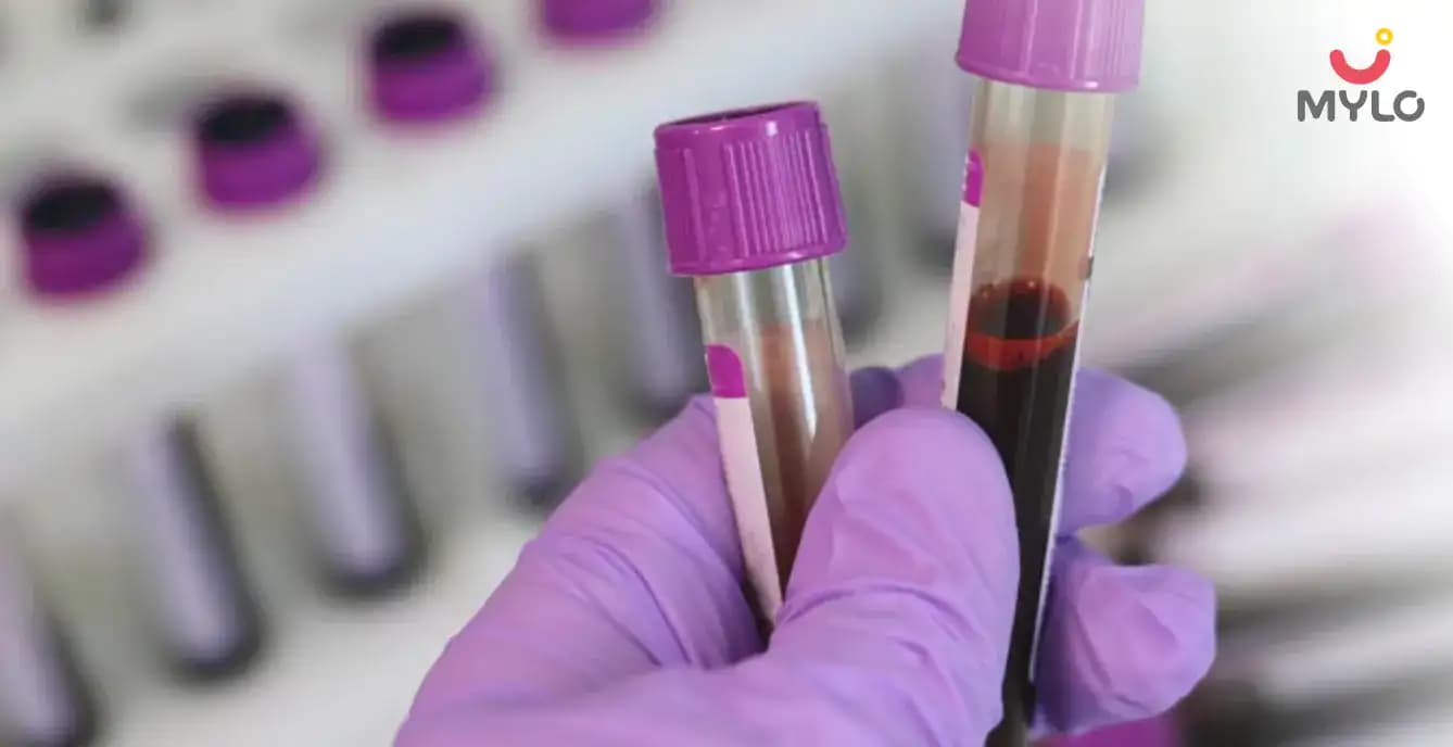 Blood Beta-hCG Test: What Is It, Levels & How to Read It?