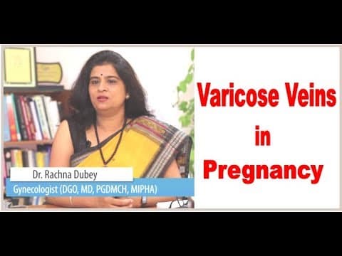Varicose Veins in Pregnancy | Dr. Rachna Dubey