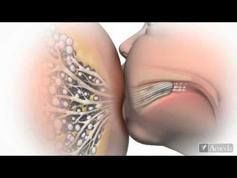 What is the Secret to Getting a Good Latch while Breastfeeding? | Video shared by  @crazymum | To share Youtube videos, reach out to us at feedback @myloapp.in ?