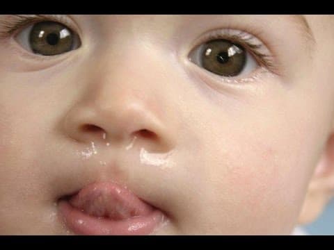 Home Remedies for Your Child's Runny Nose