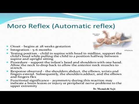 How to test neurological conditions in newborn ?