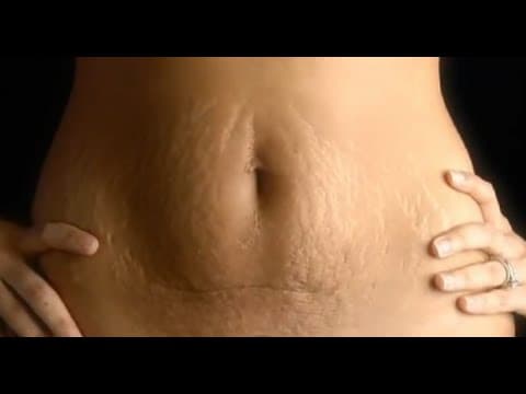 How To Tighten Loose Skin After Pregnancy
