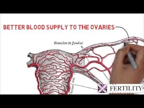 How acupuncture helps infertility?