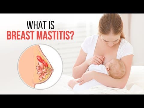 Breast Infection: All you need to know about 