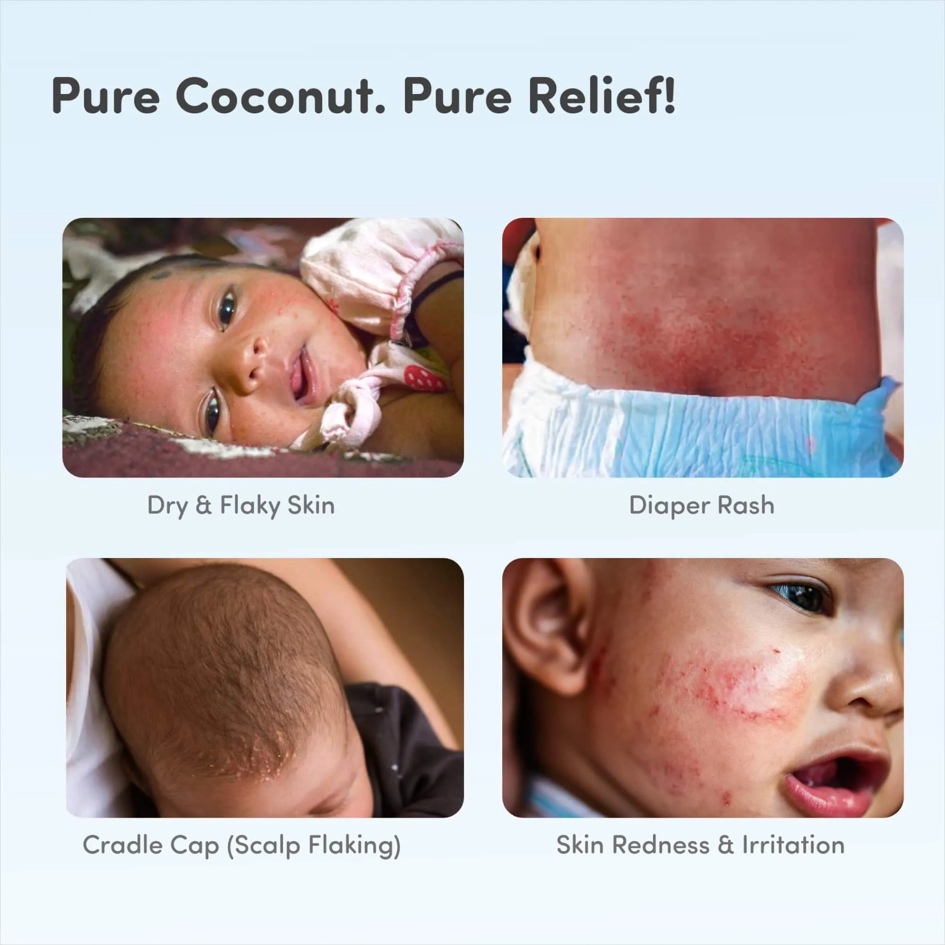 Mylo Baby 100% Cold Pressed Coconut Oil | 200 ml