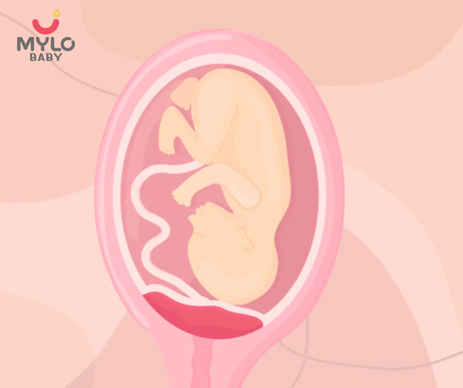  आख़िर क्या है लो लाइंग प्लेसेंटा | What is a low-lying placenta in Hindi ? 