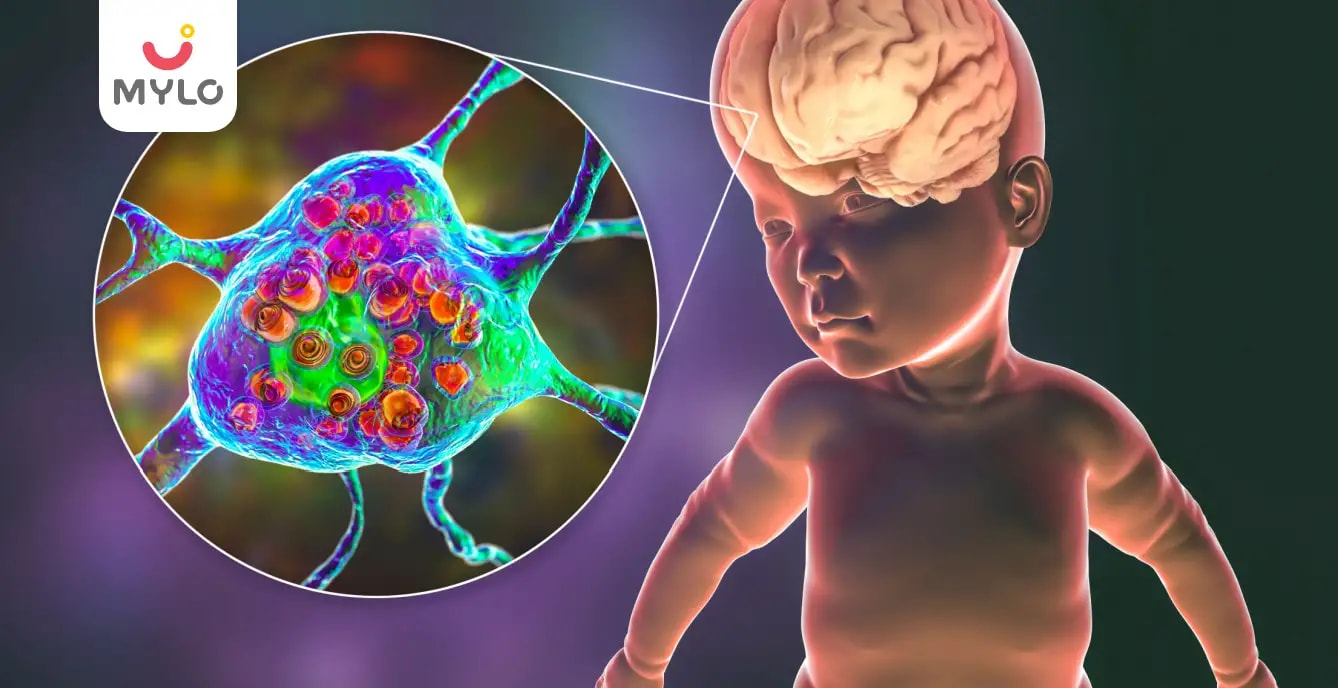 టే సాక్స్ వ్యాధి: కారణాలు, లక్షణాలు, ప్రమాదాలు & చికిత్స 