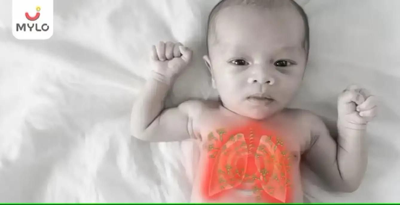 மெகோனியம் ஆஸ்பிரேஷன் சிண்ட்ரோம்: அறிகுறிகள், காரணங்கள் & சிகிச்சை(Meconium Aspiration Syndrome: Symptoms, Causes & Treatment  In Tamil)