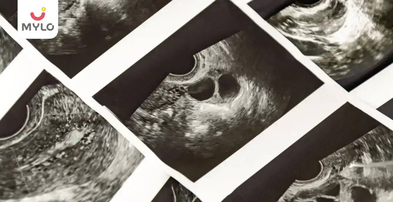உங்களுடைய 7 வார கர்ப்பத்திற்கான ஸ்கேன் அறிக்கையில் என்ன எதிர்பார்க்கலாம்?