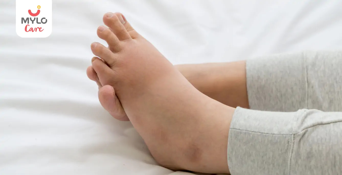प्रेग्नेंसी में पैरों की सूजन से कैसे पाएं आराम |  How to get relief from swollen feet during pregnancy in Hindi 