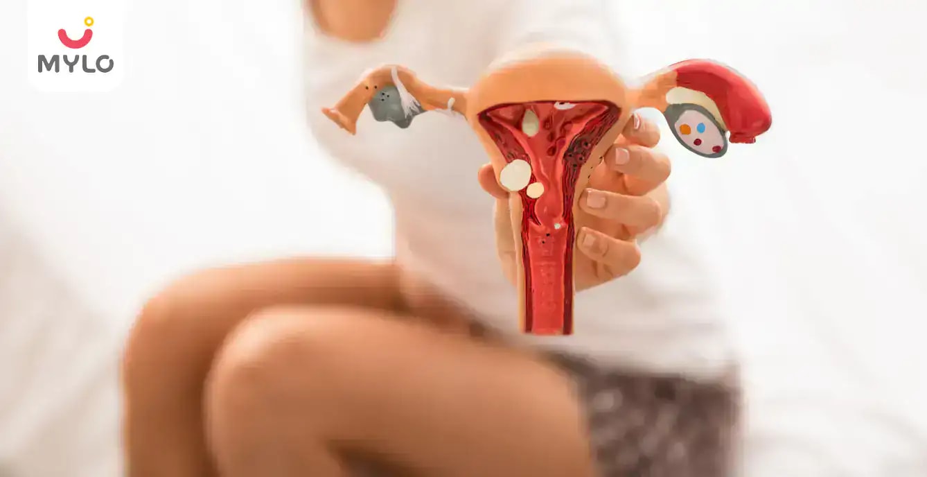 అండాశయ తిత్తి: రకాలు, కారణాలు, లక్షణాలు మరియు చికిత్స