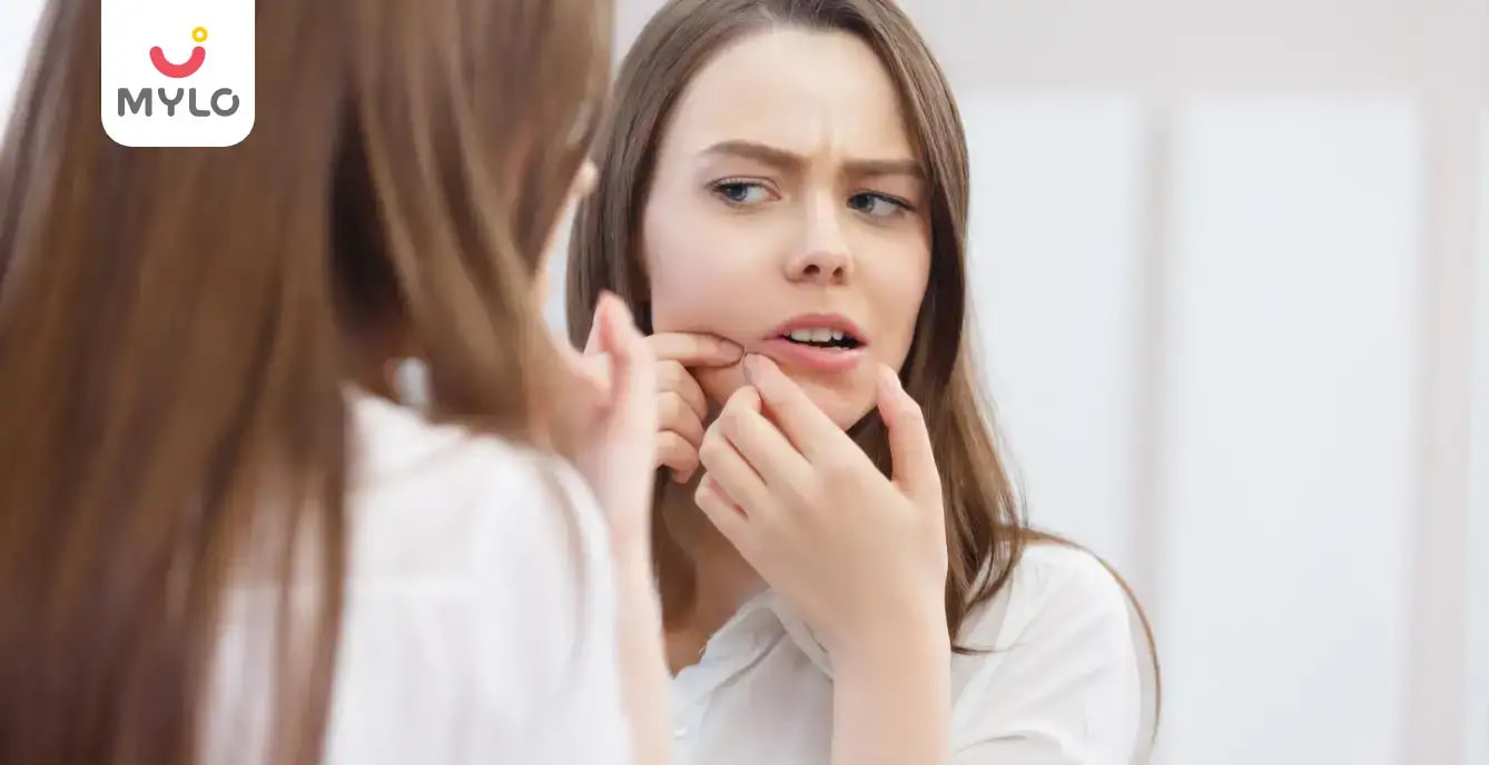 మొటిమలు అంటే ఏమిటి & ముఖం నుండి మీరు వాటిని ఎలా వదిలించుకోవచ్చు?