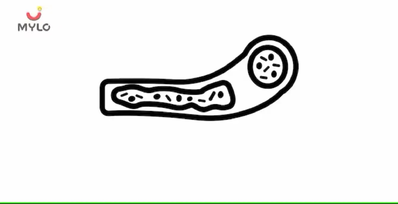   செப்சிஸ்: அறிகுறிகள், காரணங்கள், சிகிச்சை மற்றும் அபாயங்கள்(Sepsis: Symptoms, Causes, Treatment, and Risks In Tamil) 