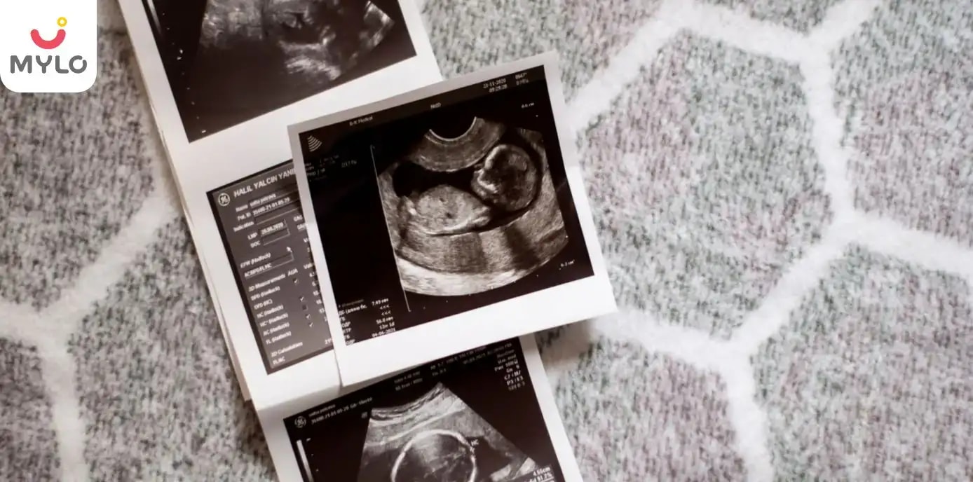 গর্ভাবস্থার দ্বিতীয় ট্রাইমেস্টারে কী-কী স্ক্যান করা প্রয়োজন (The Scans Required at the End of Second Trimester of Your Pregnancy in Bengali)