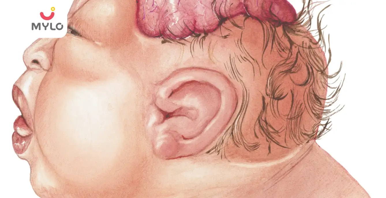 అనెన్స్‌ఫాలీ: కారణాలు, లక్షణాలు, ప్రమాదం & చికిత్స