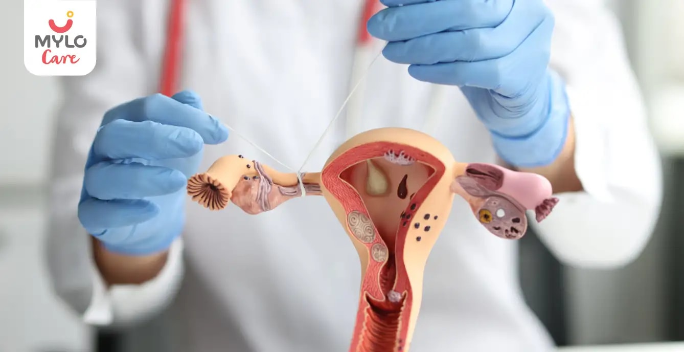 Images related to অবরুদ্ধ ফ্যালোপিয়ান টিউব: কীভাবে আপনার গর্ভধারণের সম্ভাবনাকে প্রভাবিত করে | Blocked Fallopian Tubes: How They Affect Your Chances of Conceiving in Bengali