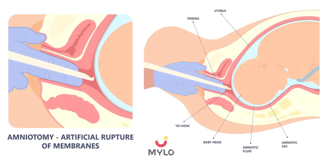 Images related to অকাল প্রসবের লক্ষণ এবং কারণগুলি কী এবং কীভাবে এটি প্রতিরোধ করা যায় (What are the Symptoms and Causes of a Premature Delivery & How to Prevent it in Bengali)