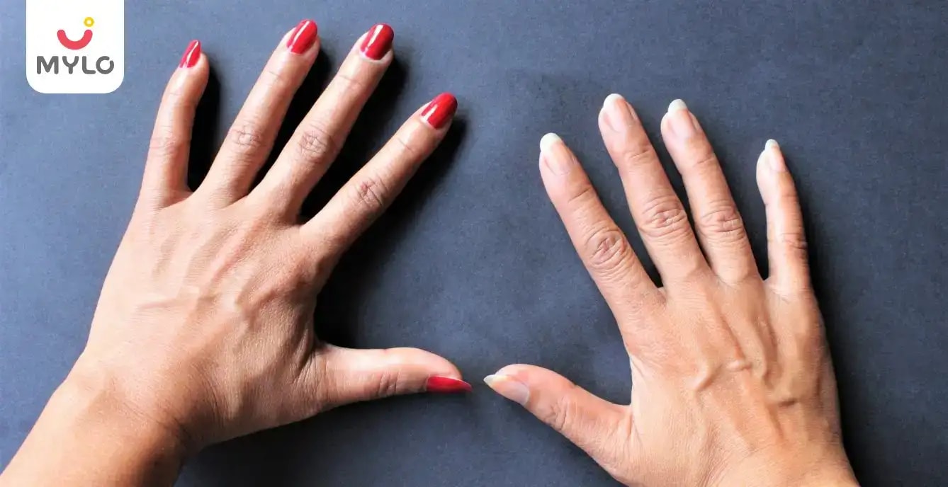 Images related to আপনার হাতের শিরাগুলি কি দেখা যায়? এটি কি কোনো দুশ্চিন্তার বিষয়? 