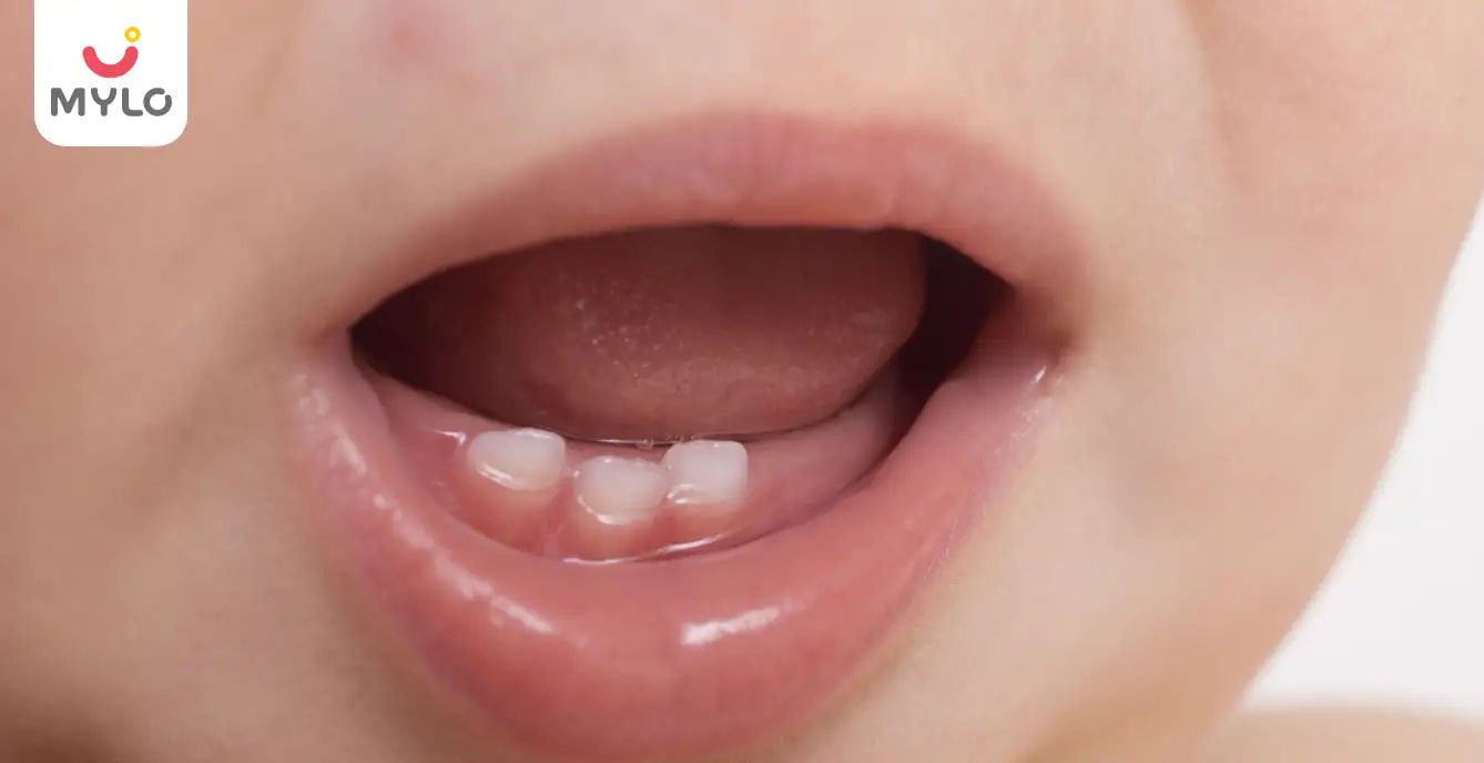 குழந்தையின் நாக்கை சுத்தம் செய்வது எப்படி?