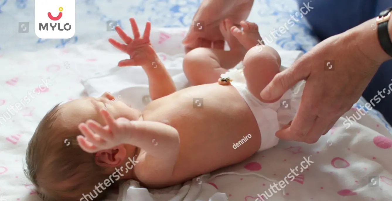 పిల్లలలో అంబిలికల్ హెర్నియా (బొడ్డు) గురించి మీకు తెలియాల్సిన నిజాలు..!