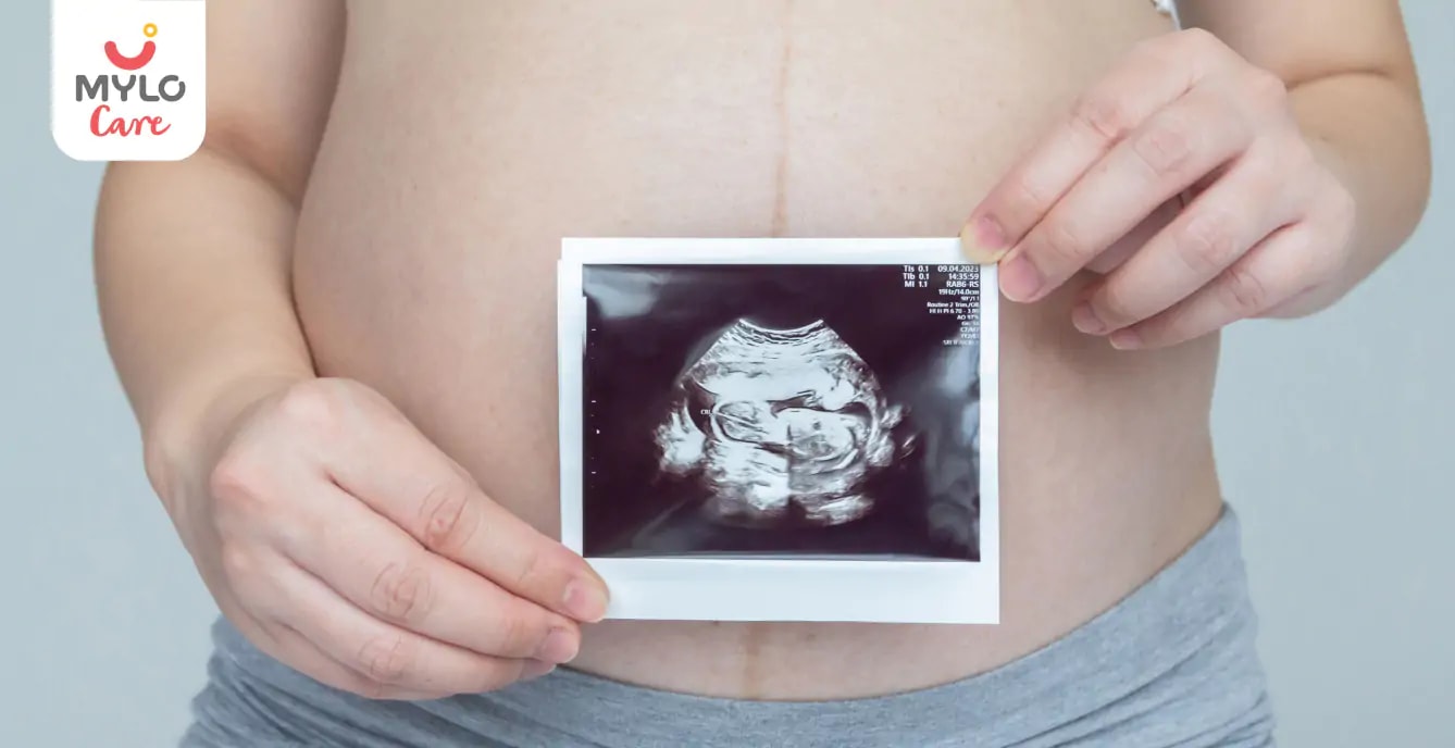 Images related to நஞ்சுக்கொடி இறக்கத்திற்கான வழிகாட்டி: அறிகுறிகள் மற்றும் சிகிச்சை | A Guide to Low Lying Placenta: Symptoms and Treatment in Tamil