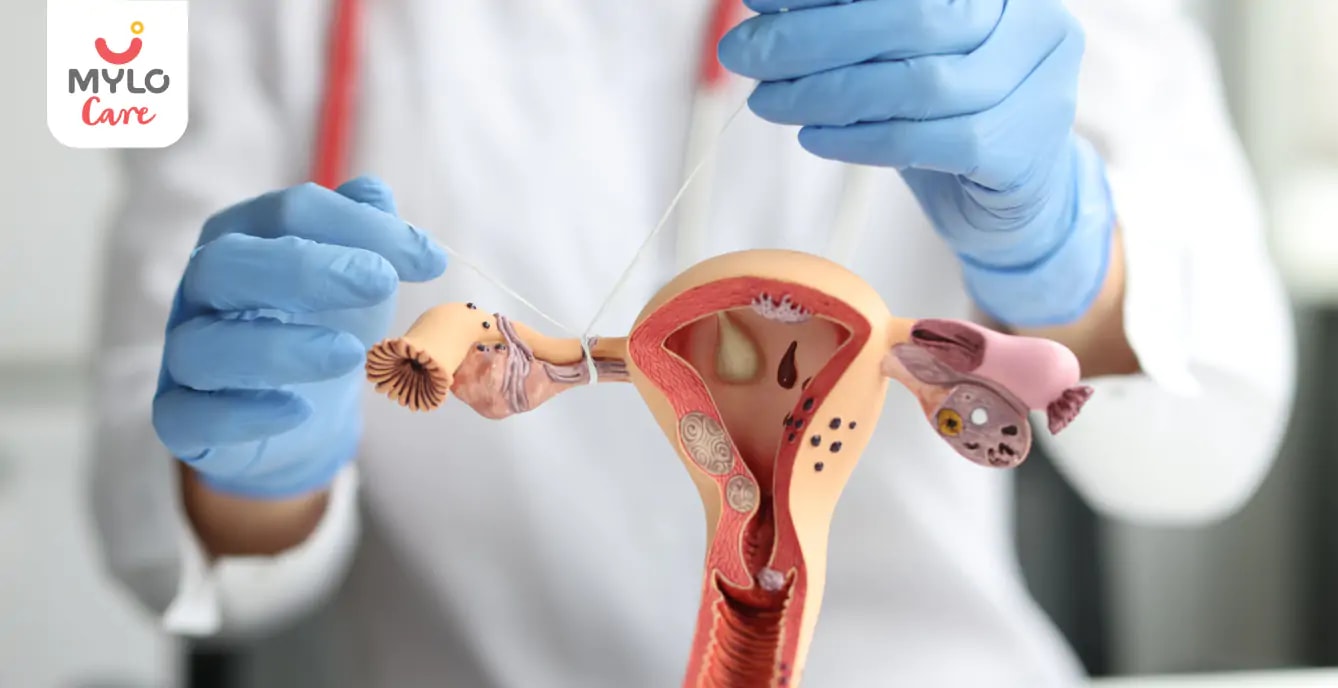 Images related to నిరోధించబడిన ఫెలోపియన్ ట్యూబ్‌లు: అవి మీ గర్భం దాల్చే అవకాశాలను ఎలా ప్రభావితం చేస్తాయి | Blocked Fallopian Tubes: How They Affect Your Chances of Conceiving in Telugu