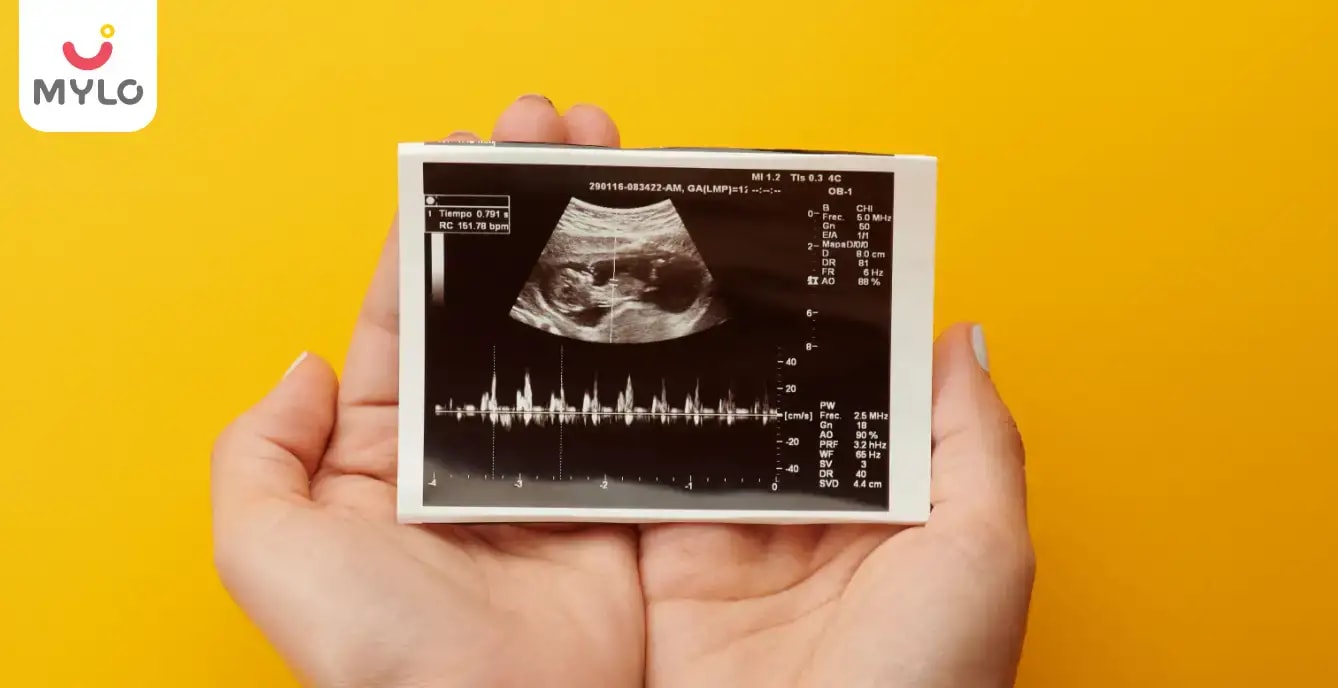 சிஆர்எல் (CRL ) என்றால் என்ன?