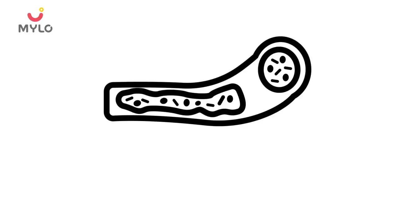 సెప్సిస్: లక్షణాలు, కారణాలు, చికిత్స మరియు ప్రమాదాలు (Sepsis: Reasons, Symptoms, Treatment and Problems in Telugu)