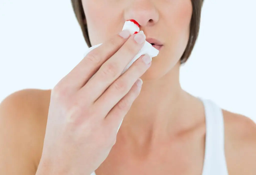 Nose bleeding during pregnancy