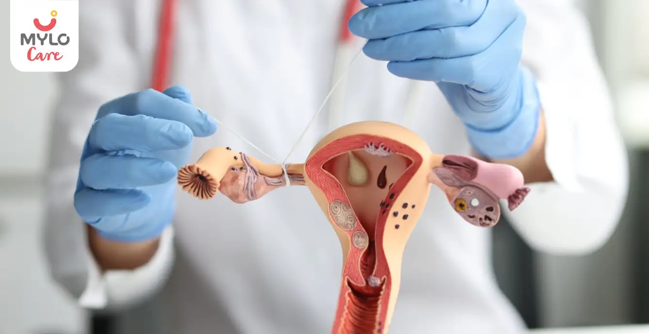 அடைப்பு ஏற்பட்ட  ஃபலோபியன் குழாய்கள்: அவை உங்கள் கருத்தரிப்பதற்கான வாய்ப்புகளை எவ்வாறு பாதிக்கின்றன I Blocked Fallopian Tubes: How They Affect Your Chances of Conceiving in Tamil    