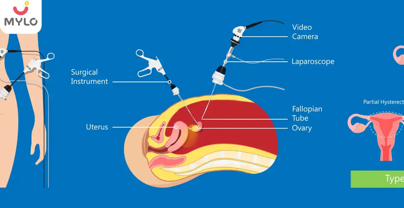 Images related to  ওভারিয়ান সিস্ট: প্রকার, কারণ, লক্ষণ ও চিকিৎসা