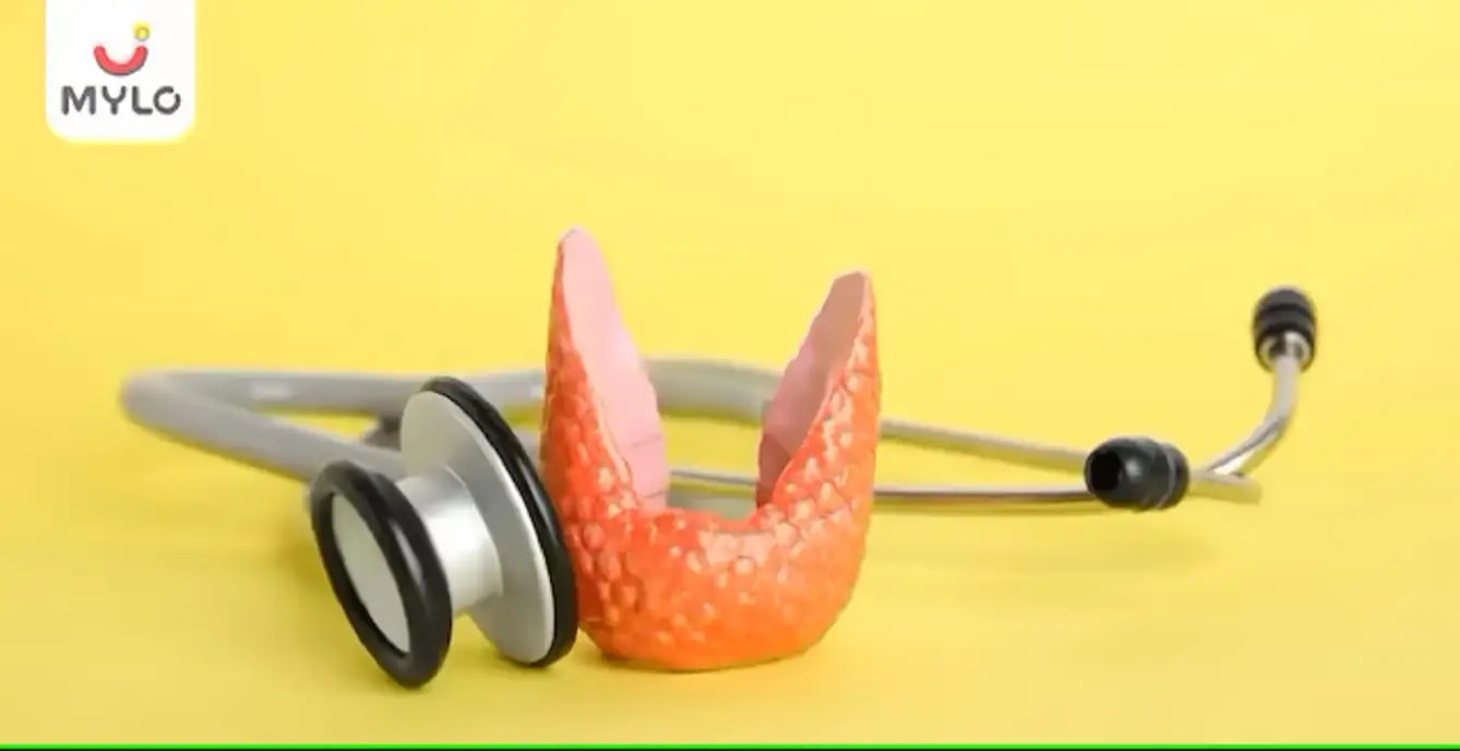 பாப்பில்லரி (காம்பு வடிவ) தைராய்டு கார்சினோமா